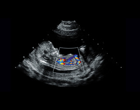 /Content/ServiceImages/fetal-canonical (1).jpg